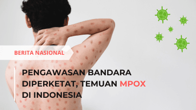 Ket foto: Temuan MPOX di Indonesia (Sumber foto: Ilustrasi/Gema Sumatra)