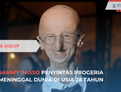 Meninggal Dunia, Sammy Basso Penyelidik Progeria