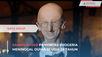 Ket foto: Sammy Basso (Sumber Foto: Pinterest/ sammybasso)